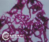 Mycobacterium tuberculosis